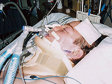Jason Gerling, after his accident, with a neckbrace and breathing aparatus in a hospital bed Jason Gerling, after his accident, with a neckbrace and breathing aparatus in a hospital bed
